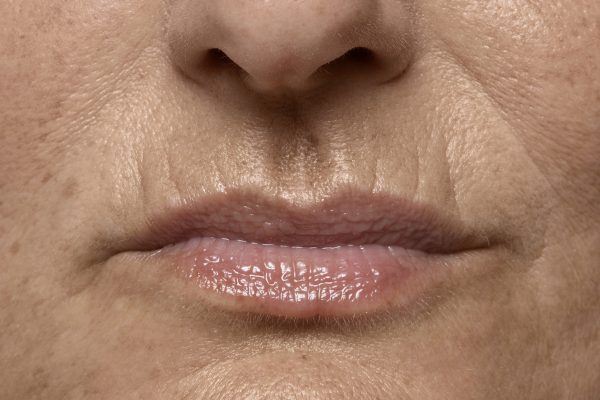 Plan o corto de mujer adulta edad media avanzada, con arrugas peribucales "código de barras"!